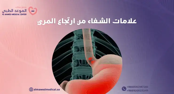 علامات الشفاء من ارتجاع المرئ