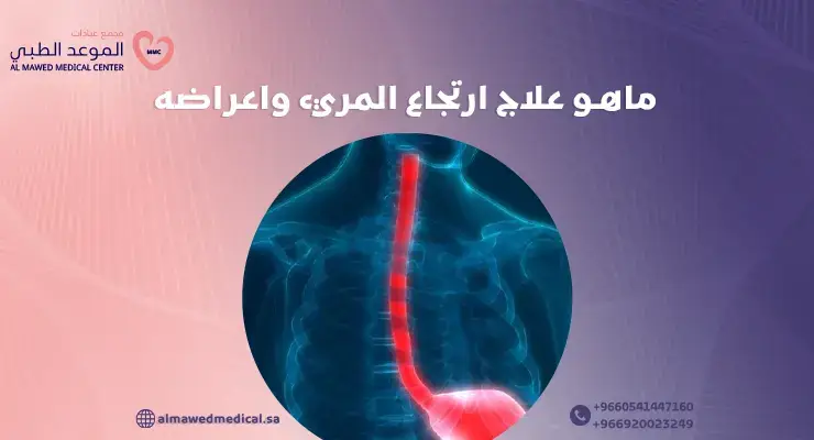 ماهو علاج ارتجاع المريء واعراضه